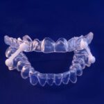 The Benefits of Invisalign in Woodland Hills