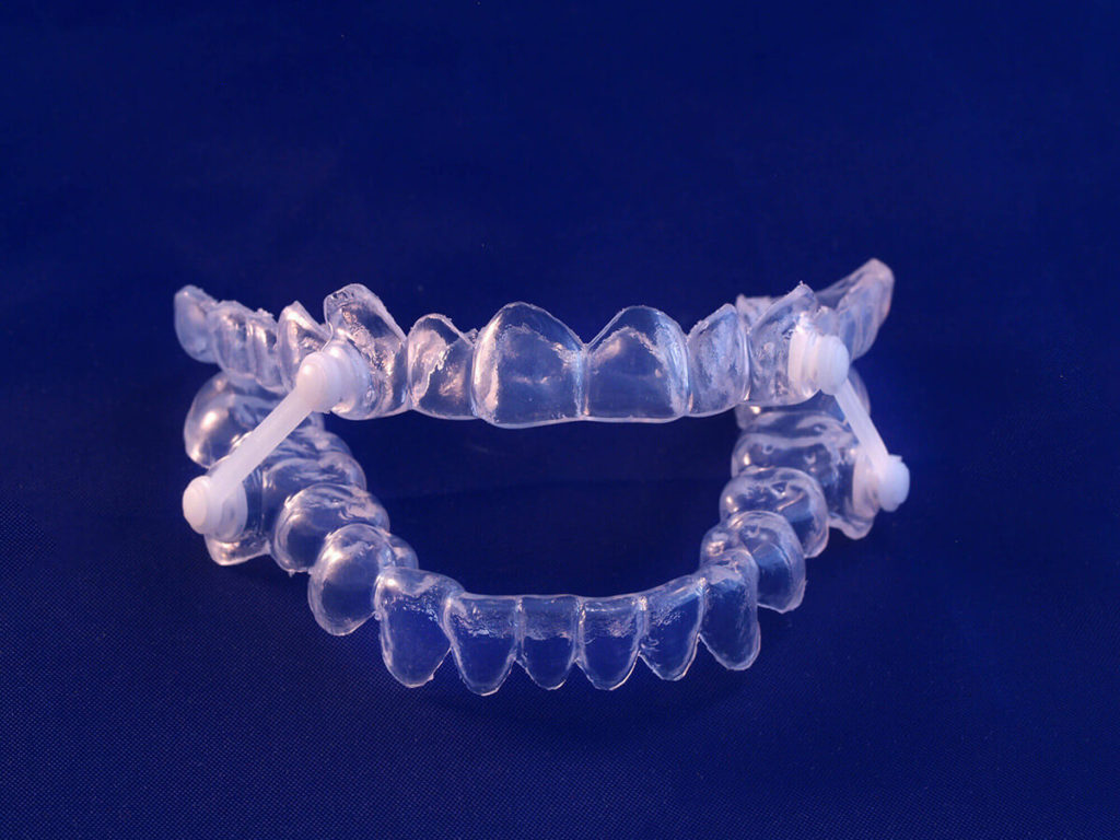 The Benefits of Invisalign in Woodland Hills