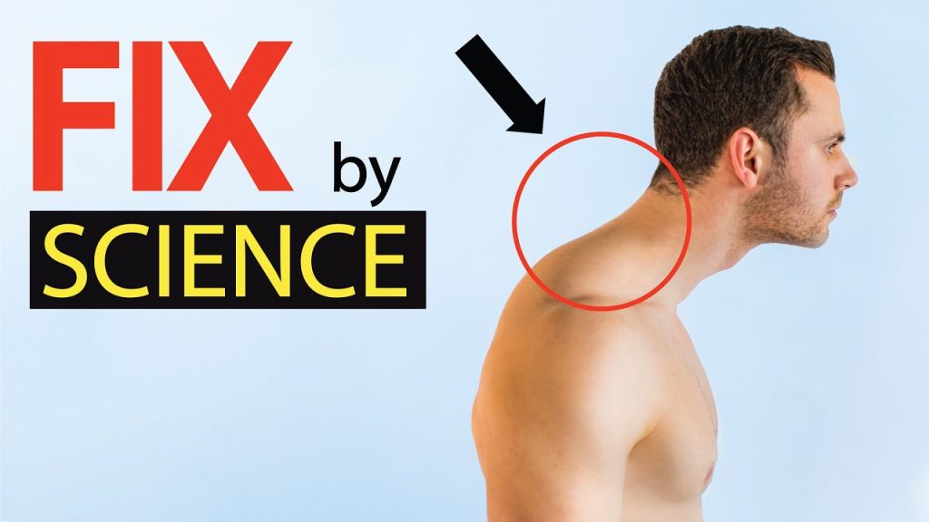 How to Fix Nerd Neck: A Comprehensive Guide