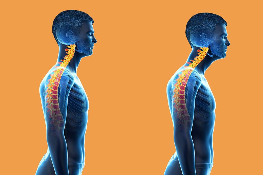 Is Forward Neck Really That Dangerous?